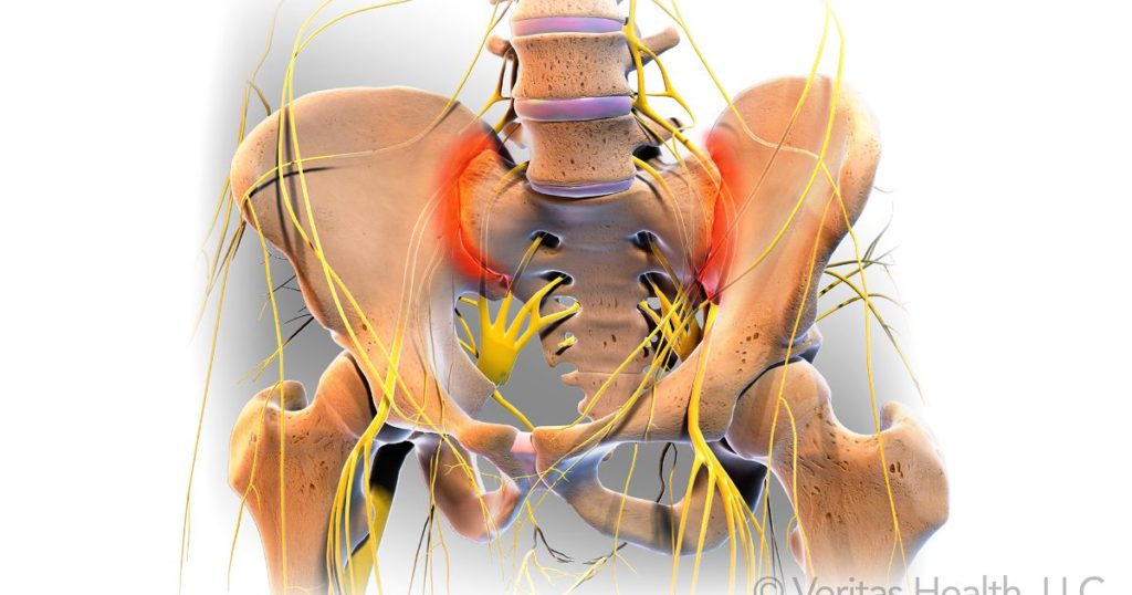 articulația doare cu adevărat tratamentul artrozei prin tamburină
