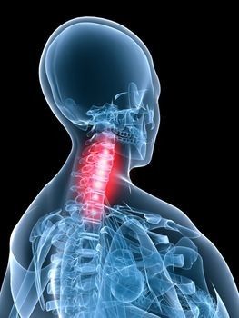 tratamentul complex al osteocondrozei coloanei vertebrale